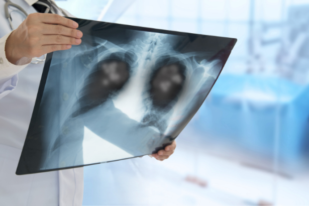 Dra. Thaline Neves destaca a importância de um laudo radiológico bem interpretado para garantir diagnósticos precisos e tratamentos eficazes.